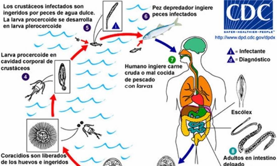 4 nuevos casos de personas infectadas con parásitos por el consumo de pescado crudo
