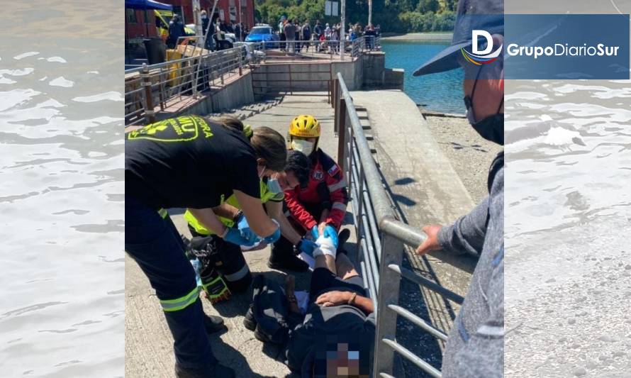 Lobo marino mordió a hombre en Angelmó