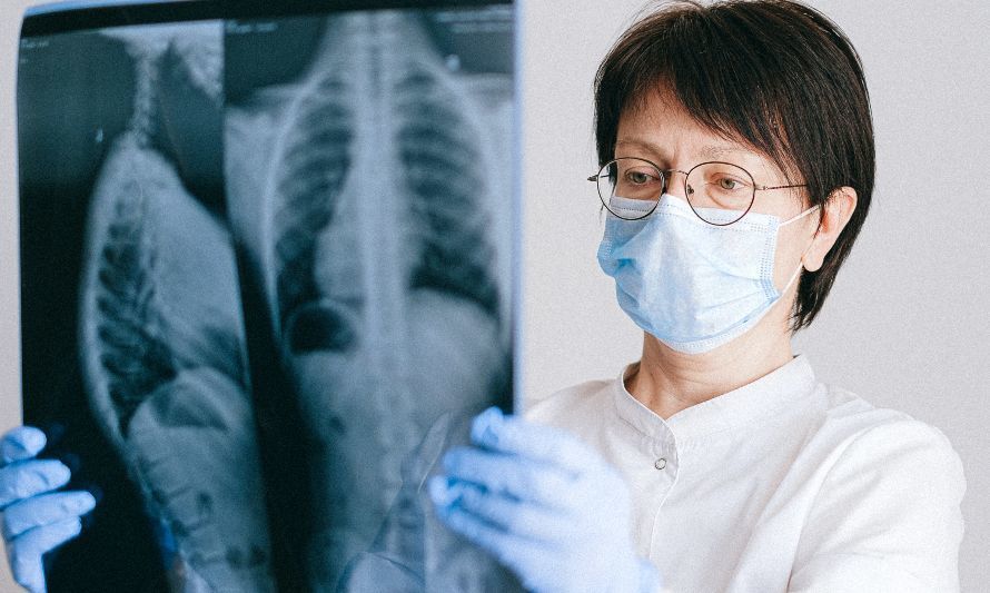 Tuberculosis: La enfermedad olvidada que está en aumento de incidencia y mortalidad